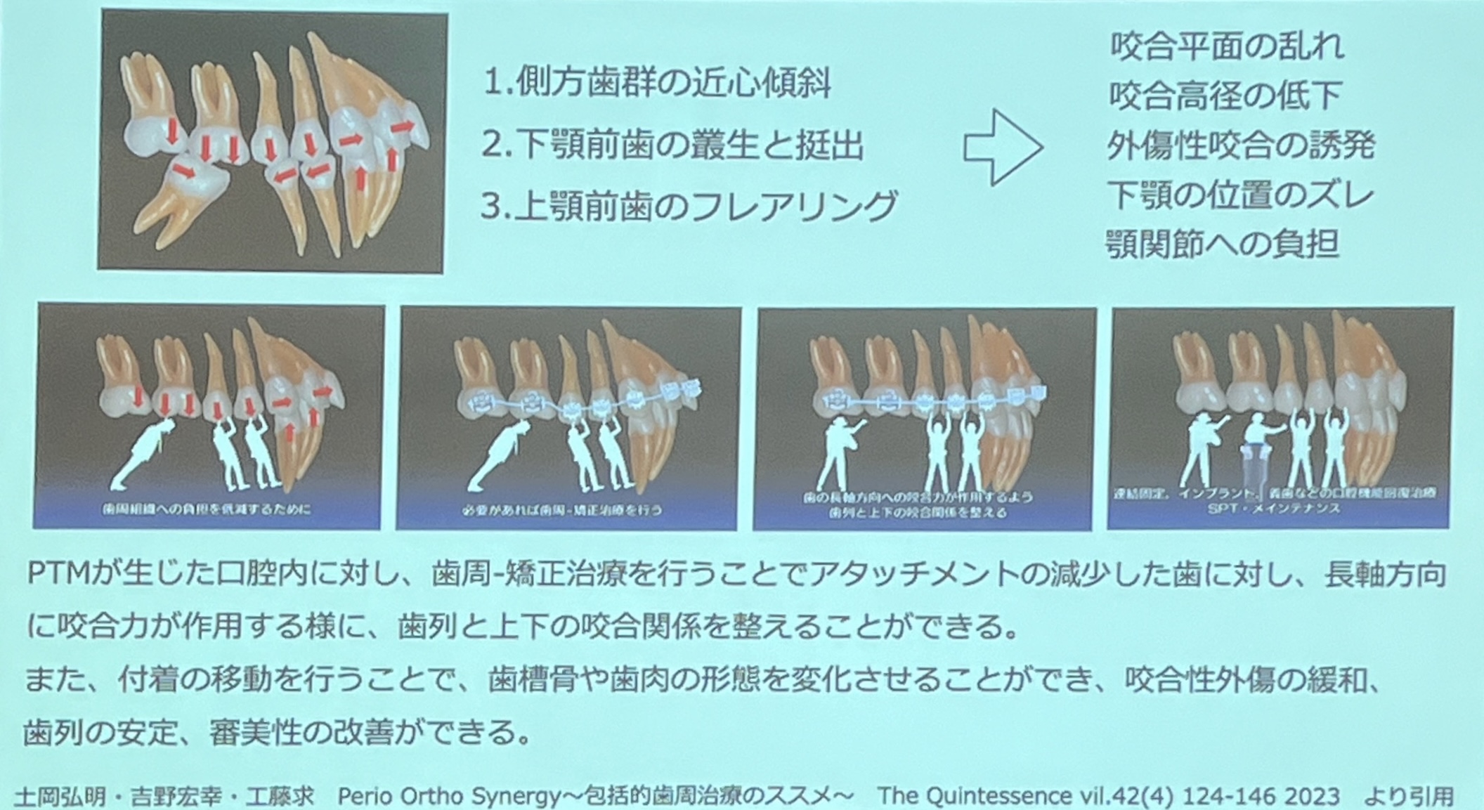 日本歯周病学会@郡山